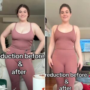 SI-Swimsuit-Model-Gigi-Robinson-Says-Breast-Reduction-Helped-Her-Chronic-Illness-TikTok